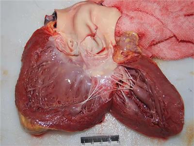 The characteristics of thoracic aortic dissection in autopsy-diagnosed individuals: An autopsy study